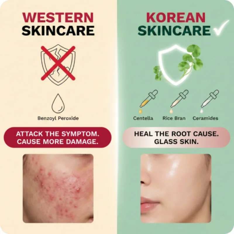 They Treat Acne Like A Wound