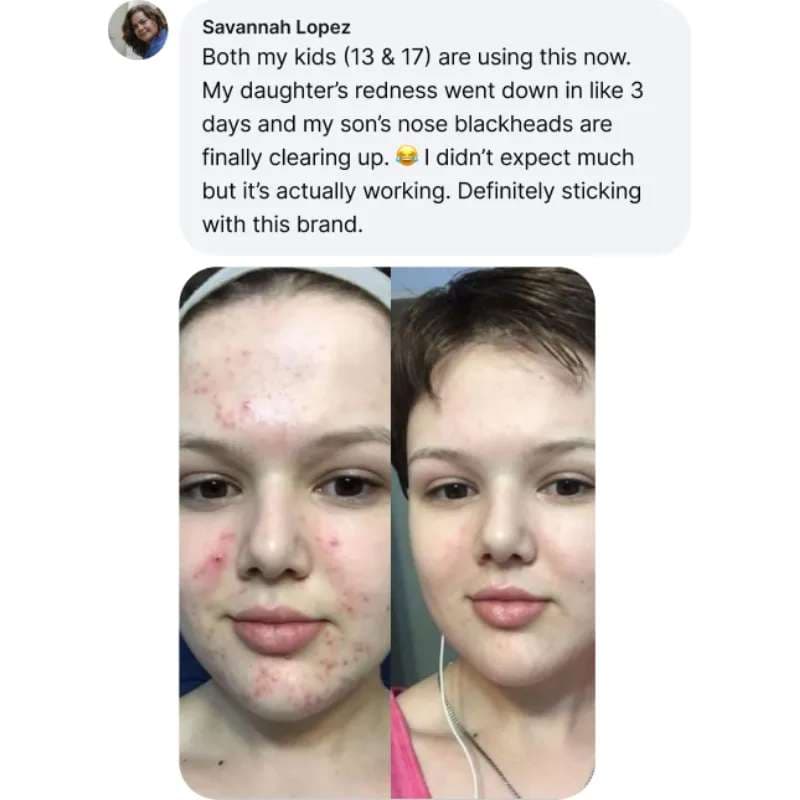 Recent Transformation 2