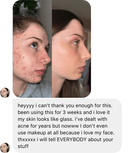 Chat Message Review - Using for 3 weeks and skin looks like glass