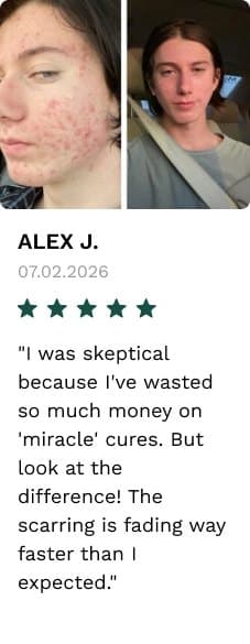Review by Alex J.